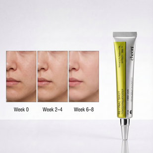 Stay Consistent, Watch Skin Transform